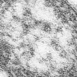 PENNSYLVANIA MEASLES OUTBREAK NEARS 800 CASES