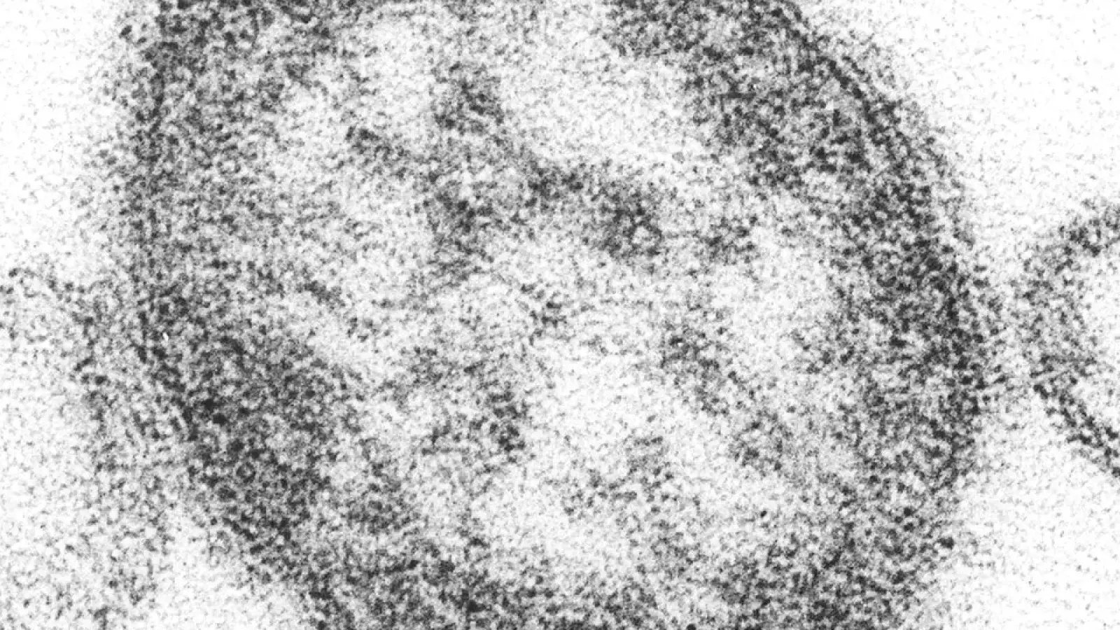 PENNSYLVANIA MEASLES OUTBREAK NEARS 800 CASES